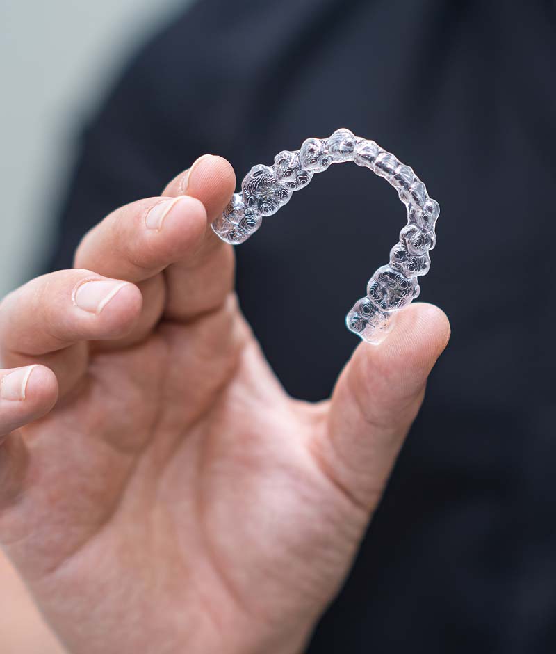 clear aligners Indianapolis, IN