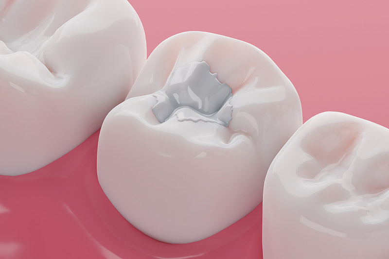 restorative dentistry Indianapolis, IN