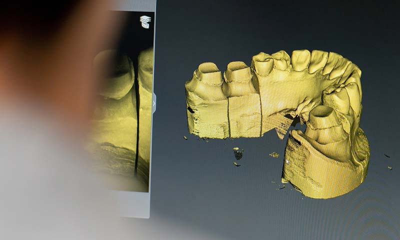 3D models used to help restore patient's smiles at Glendale Dental Associates