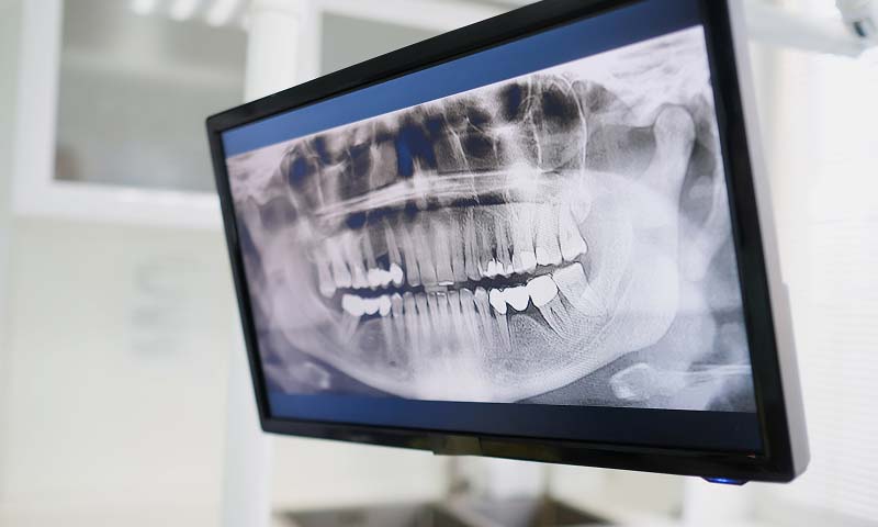 x-rays used to help treat patient's smiles