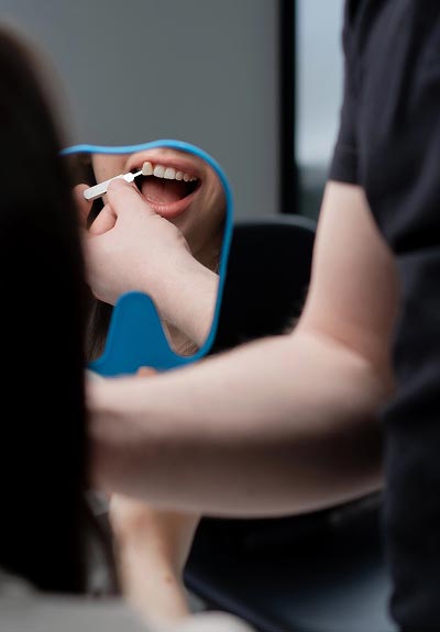 dental veneers Indianapolis, IN