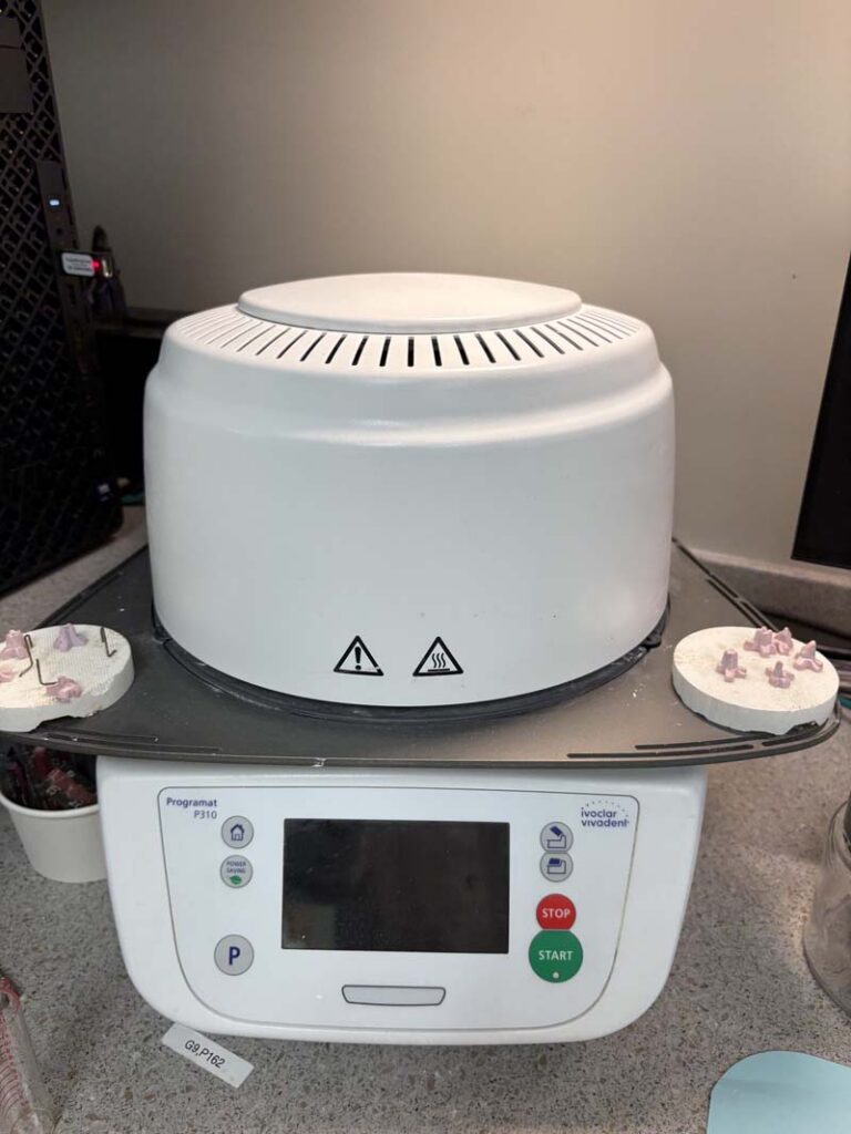 restorations crafted at Glendale Dental Associates